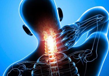 intenso dolore al collo con osteocondrosi avanzata