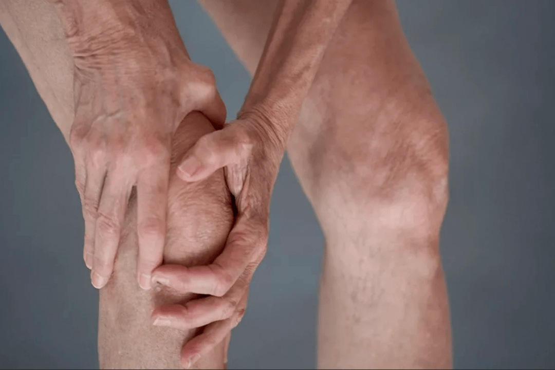 il dolore alle articolazioni può essere la causa dell'artrosi o dell'artrite
