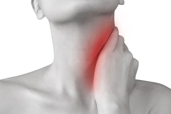 infiammazione dei linfonodi come causa di dolore al collo
