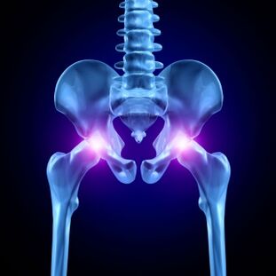 Il dolore alle articolazioni dell'anca può essere acuto, doloroso o cronico