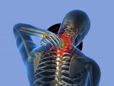 Una persona con osteocondrosi della colonna cervicale è infastidita dal dolore al collo